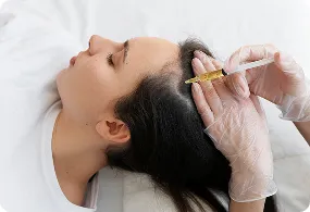 PRP Hair Regrowth